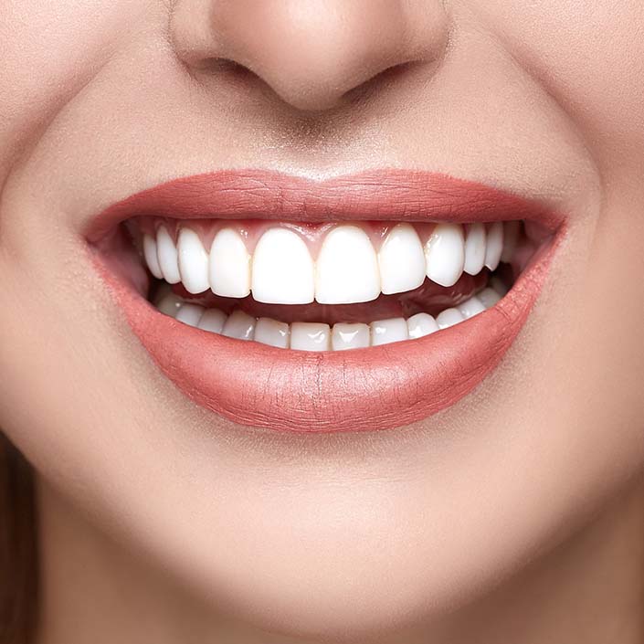 upclose image of a smile