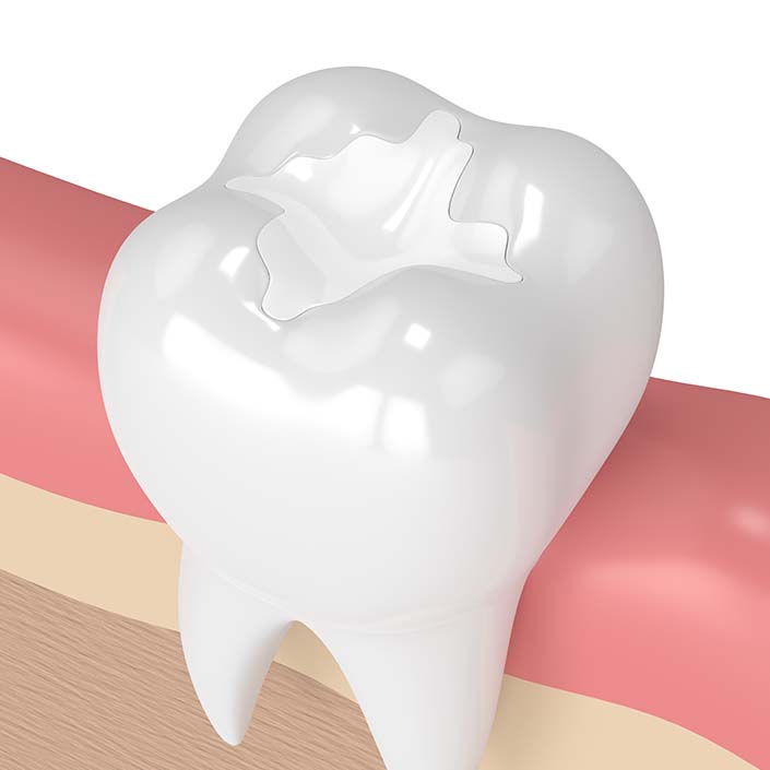 illustration of filling