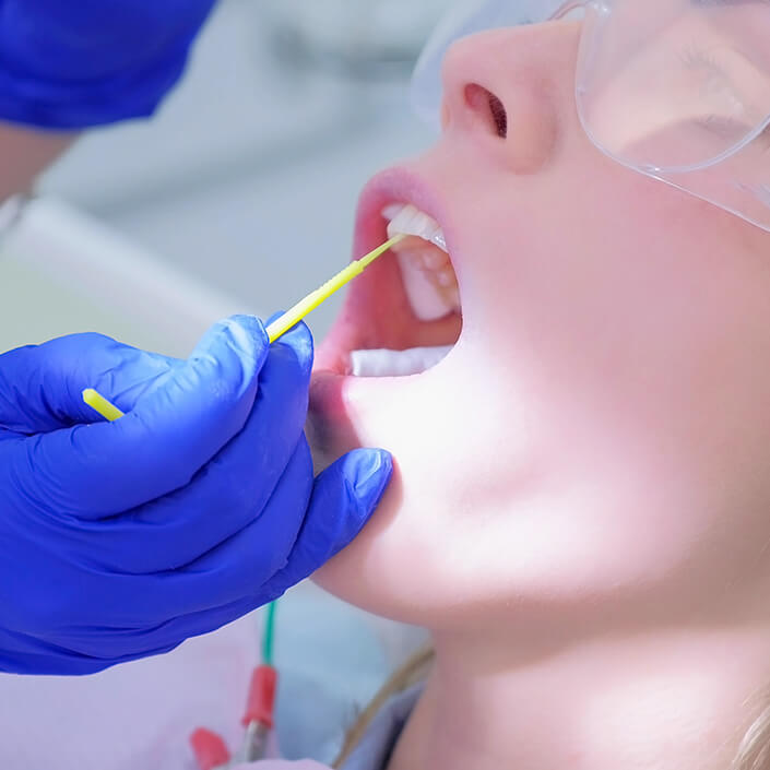 dental patient receiving fluoride treatment