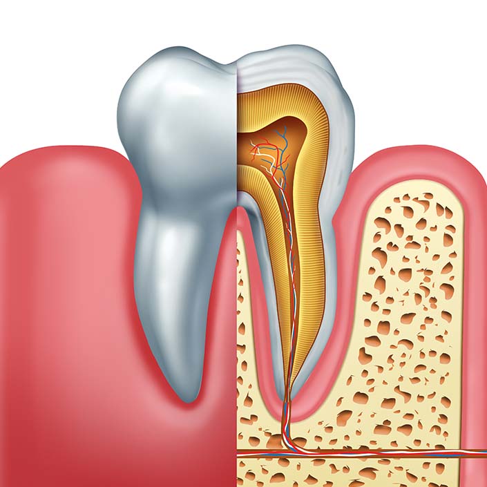 illustration of a root canal