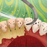 image of a dental cleaning or deep cleaning