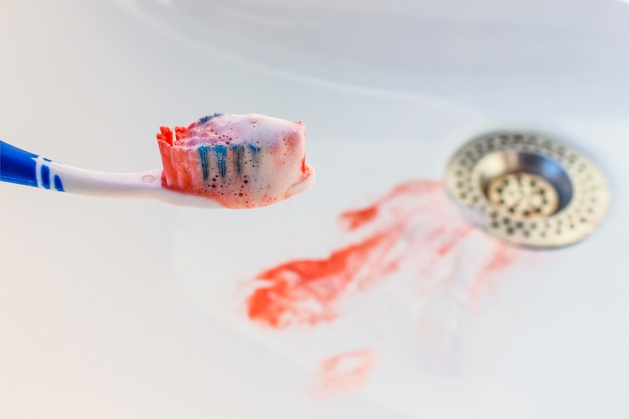 bleeding gums, periodontal disease, gum health